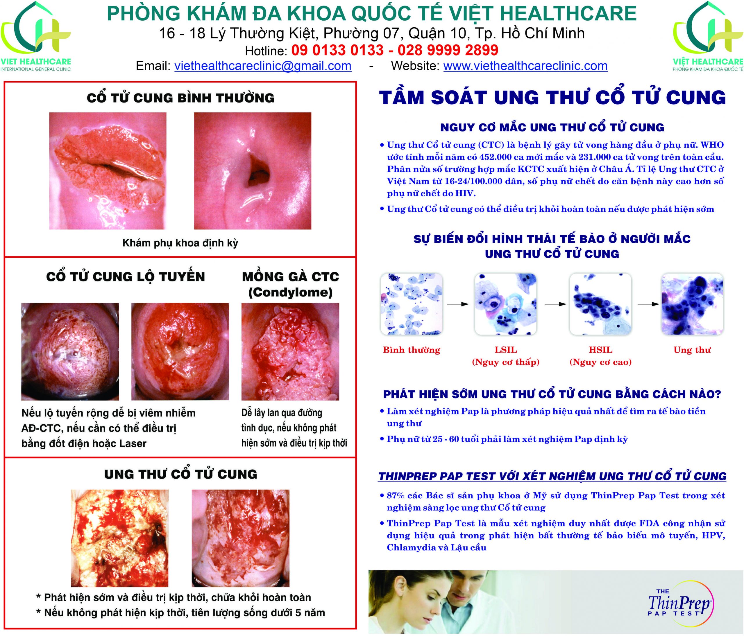 Địa Chỉ Tầm Soát Ung Thư Cổ Tử Cung Uy Tín
