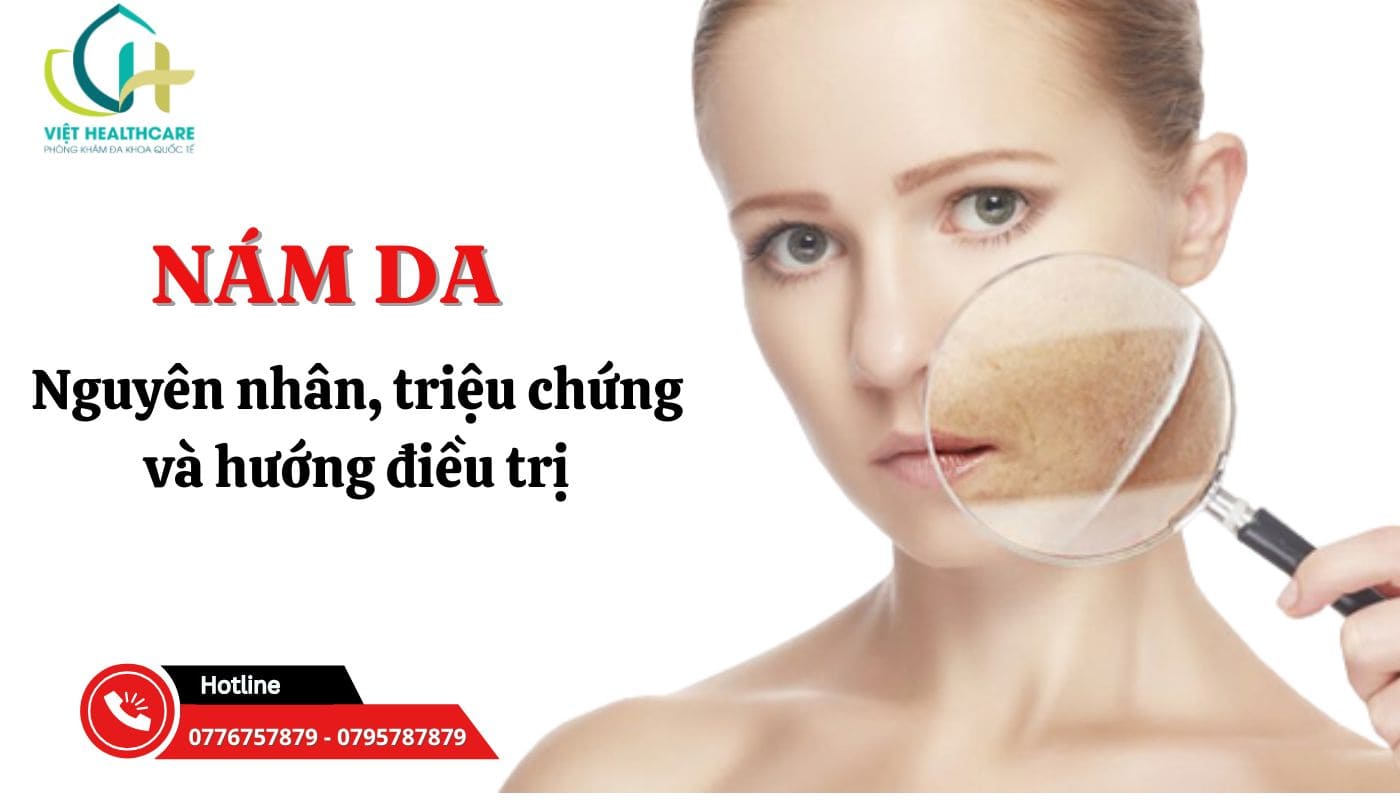 Nam da la gi