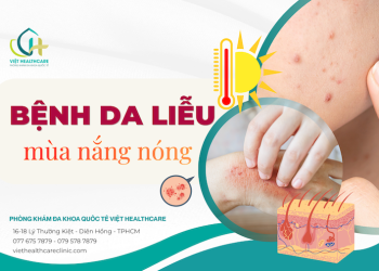 Các bệnh da liễu thường gặp trong mùa nắng nóng